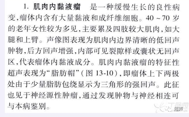 图像挺典型的,考虑什么?-第3张图片-贝塔运维 图像挺典型的,考虑什么?-第3张图片-贝塔运维
